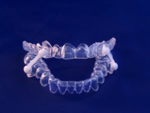 Oral Appliance