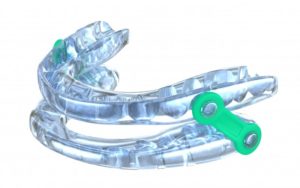 sleep apnea mouthguard 