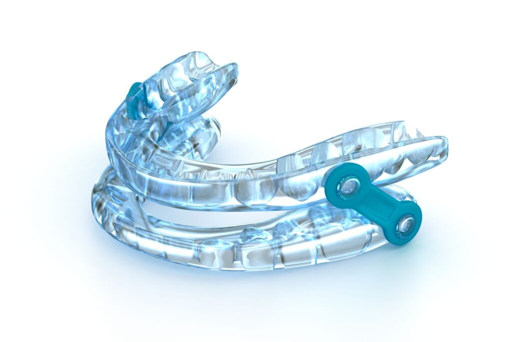 An oral appliance used to treat sleep apnea